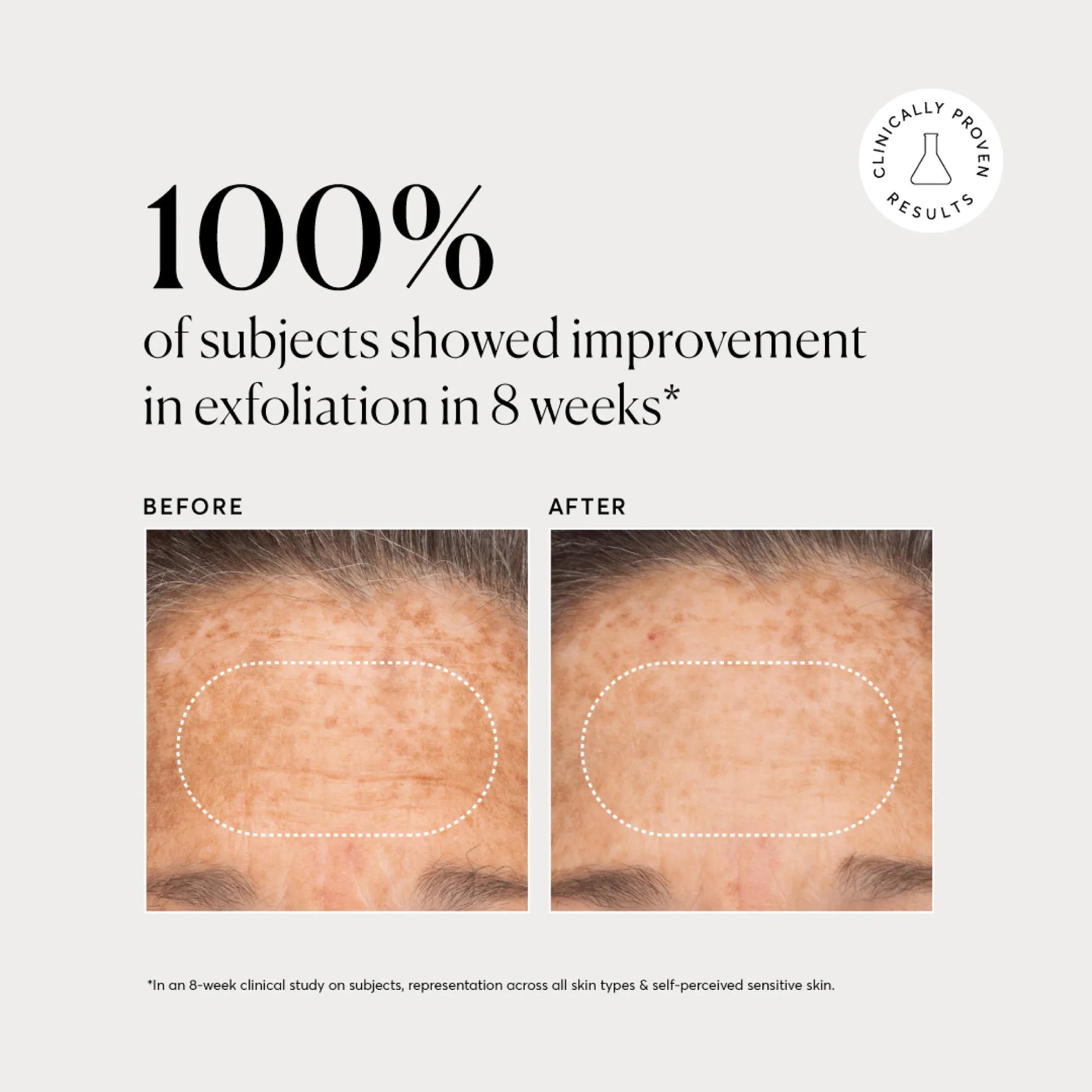 bha-liquid-exfoliant-2-s2 NATR-10027-Alt-Images-BHA-Liquid-Exfoliant-2_-03.webp